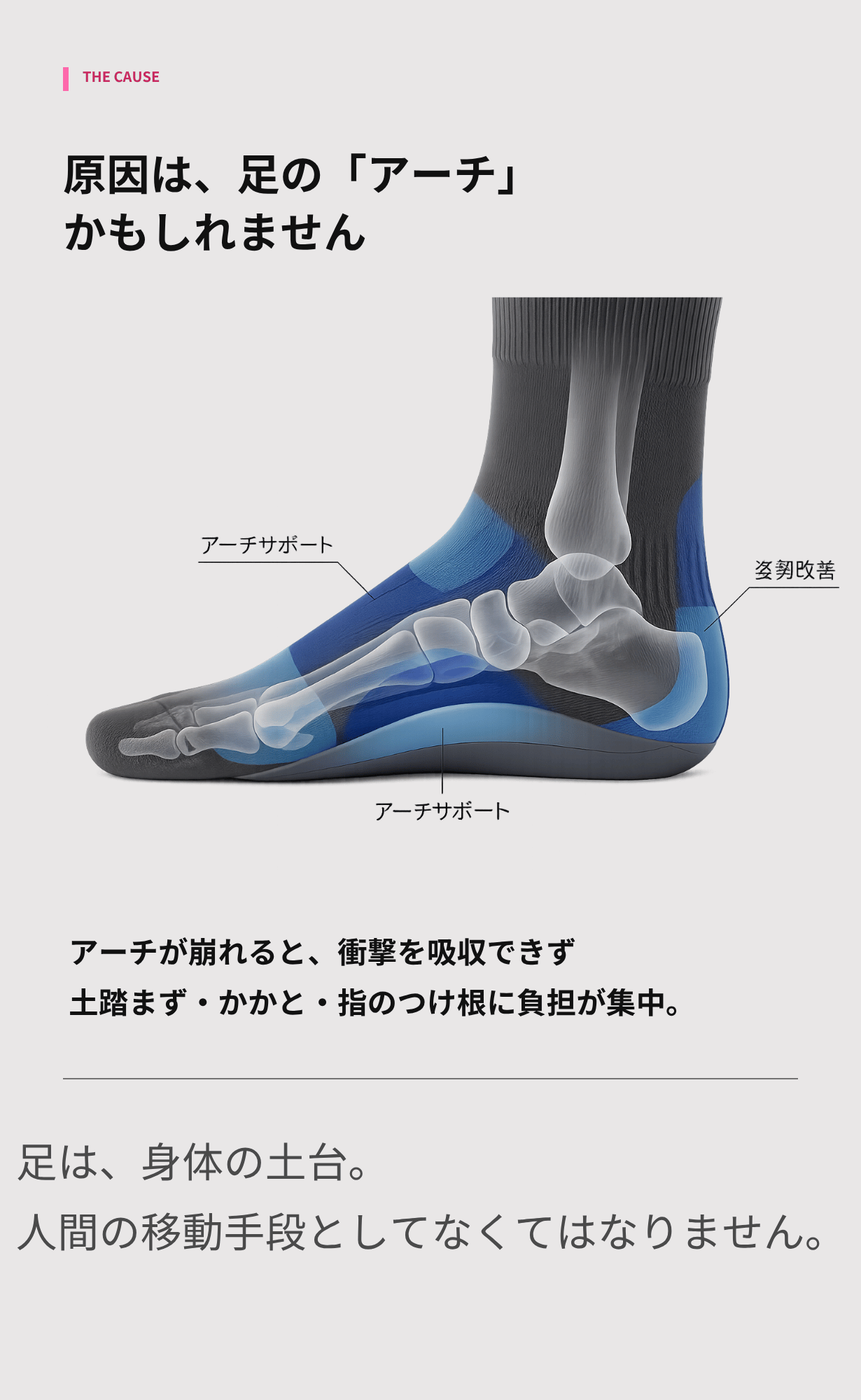 FARS 紹介画像:原因はアーチ