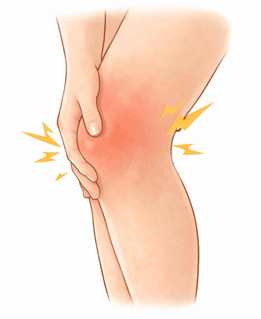 変形性膝関節症