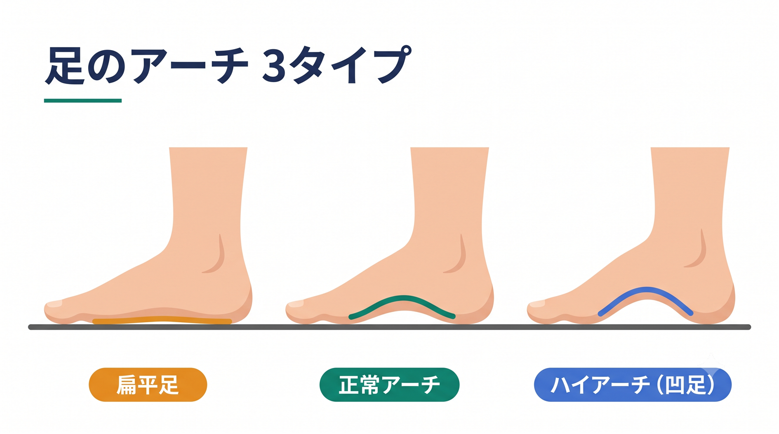 扁平足・正常アーチ・ハイアーチ（凹足）の土踏まずの違いを側面から見た図解