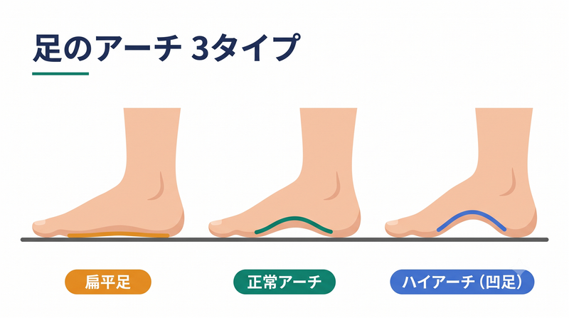 扁平足・正常アーチ・ハイアーチ（凹足）の土踏まずの違いを側面から見た図解