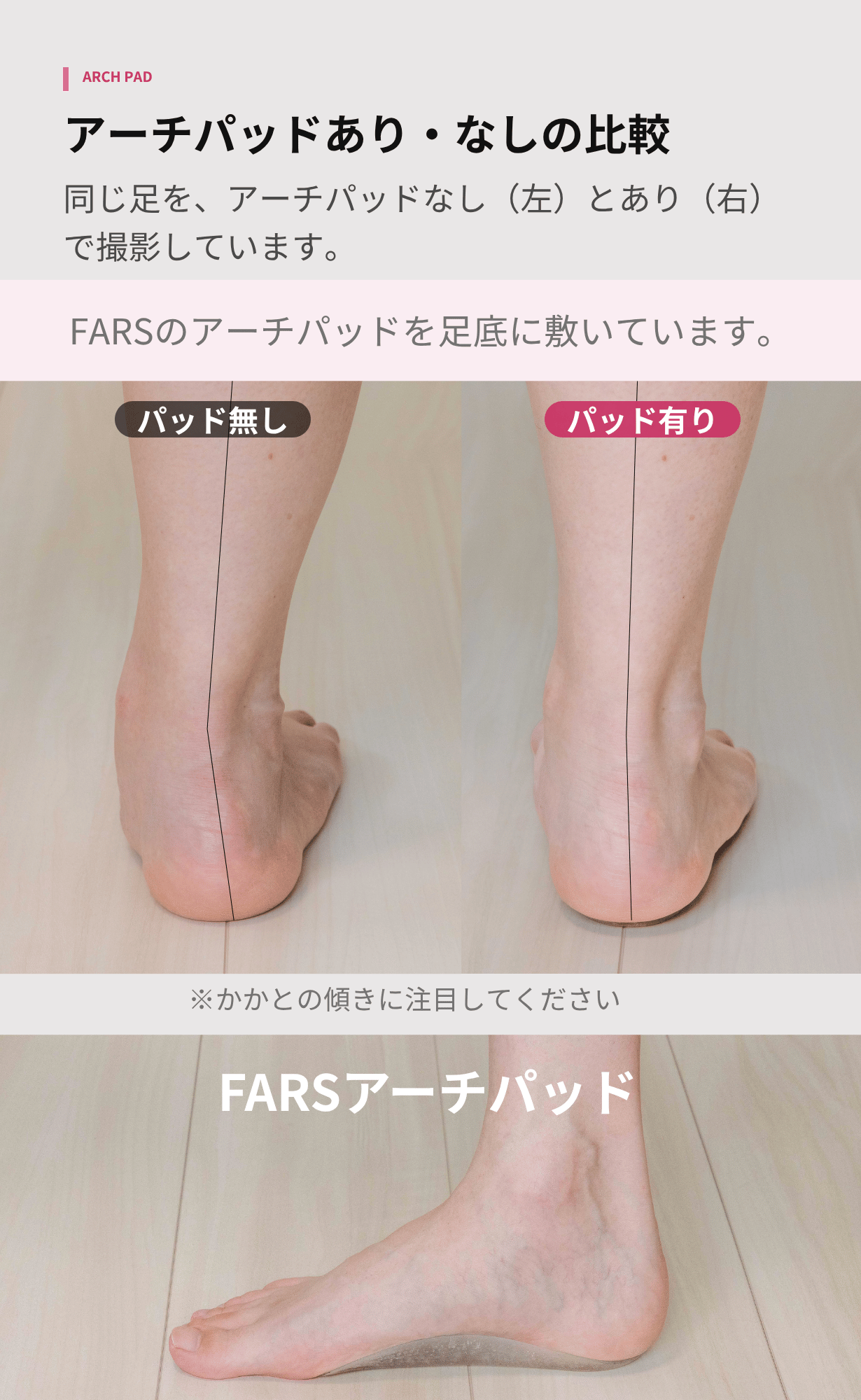 FARS 紹介画像：アーチパッド有無
